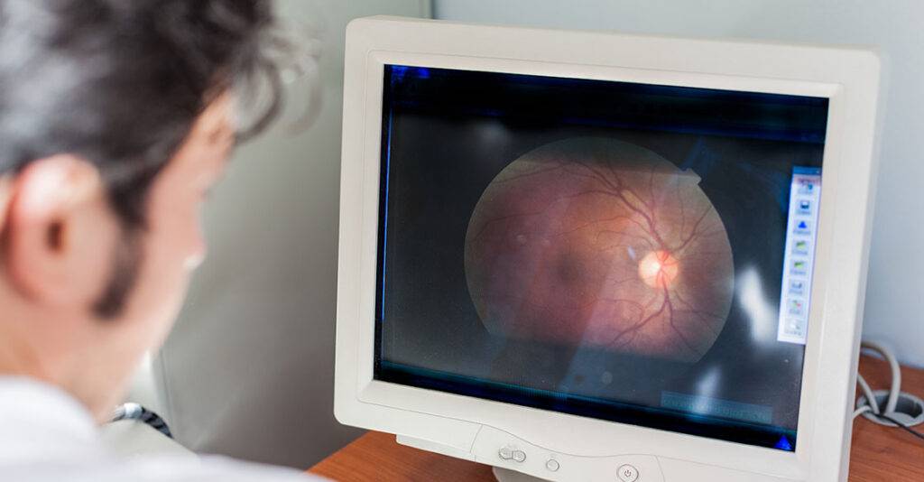 digital retinal imaging ReVision Optometry